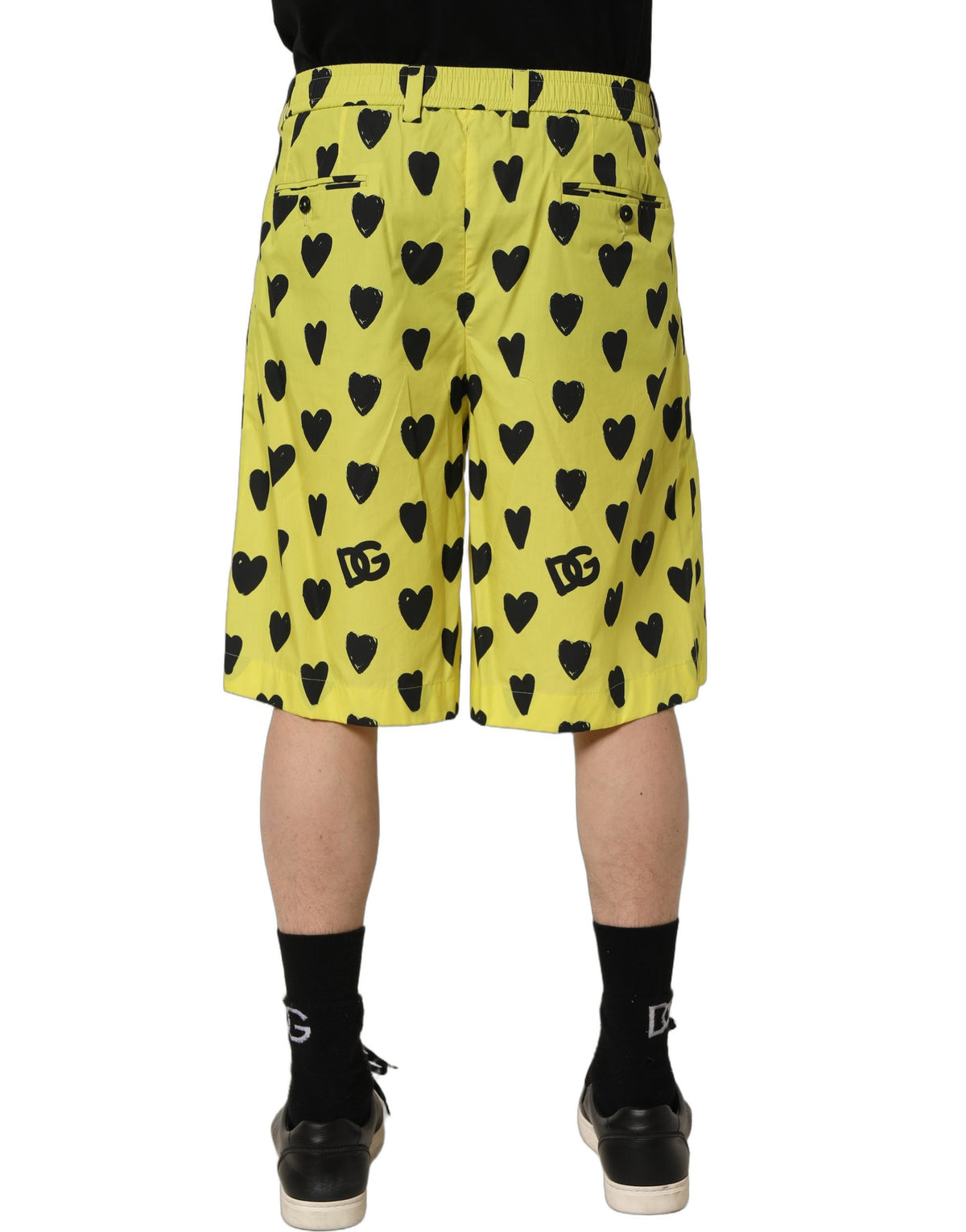 Dolce & Gabbana Yellow Cotton Heart Print Men Bermuda Men's Shorts
